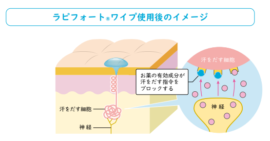 ラピフォートワイプ使用後のイメージ